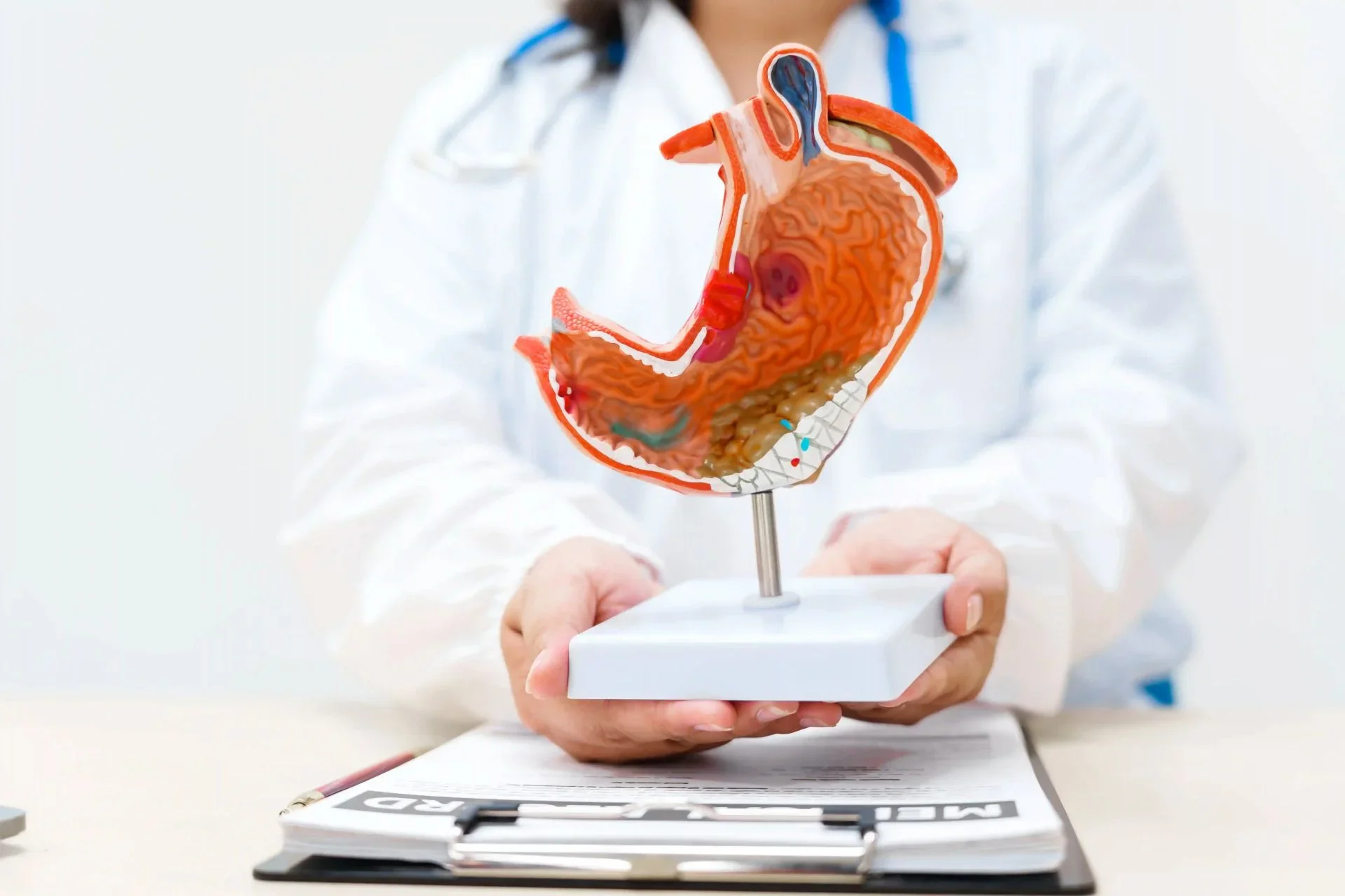 ¿Qué es el balón intragástrico? Todo lo que debes saber